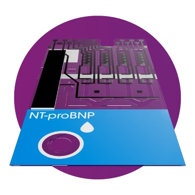 NT-proBNPテスト